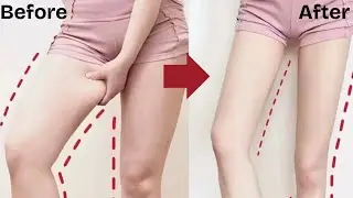 Effective & Quickly Exercise To Slim Thighs, Straight Legs in 3 Minutes 🔥 Beginners Friendly. #viral