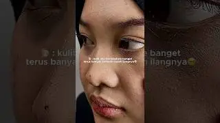 apapun masalah kulitnya, masker Pure Charcoal Mud Mask solusinya!😋🤍#azrinabeauty #funwithazrina