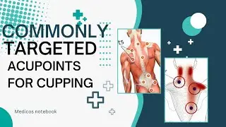 acupoints for cupping therapy|Four types of acupoints|physiotherapy|Chinese medicine