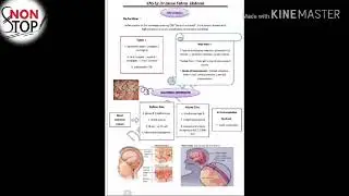 Pediatric 1: meningitis (pediatric)