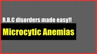 Microcytic Anemias made easy | R.B.C Disorders | Hematology Usmle Step 1 |