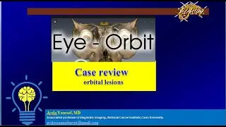 orbit case review