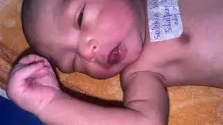 New born baby nicu admit cute baby like subscribe me 🙏🩼