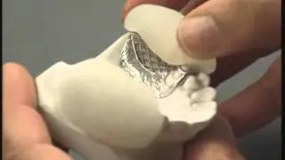 light cure partial denture