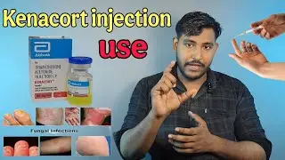Kenacort injection / Triamcinolone steroid infection uses, side effects 