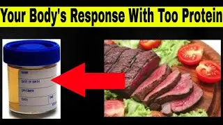 Signs That You Are Eating Too Much Protein - How Do You Know If You Are Eating Too Much Protein?