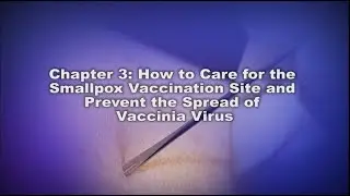 Chapter 3: How to Care for the Smallpox Vaccination Site and Prevent the Spread of Vaccinia Virus