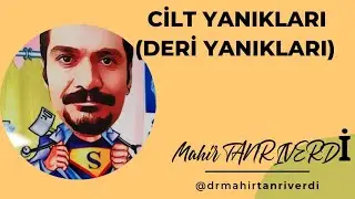 CİLT YANIKLARI - DERİ YANIKLARI - YANIK TEDAVİSİ