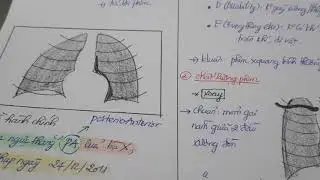 X-quang 1 - Tổng quan cách đọc phim x-quang ngực thẳng