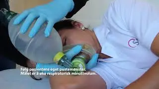 Assistert ventilasjon i sideleie