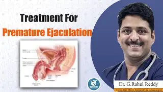 Treatment For Premature Ejaculation || Dr Rahul Reddy || Androcare Andrology Institute