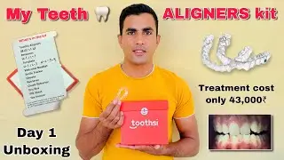 My Invisible Aligner || Unboxing of Aligner | Invisible Cost 43,000₹ in India | Toothsi teeth Result