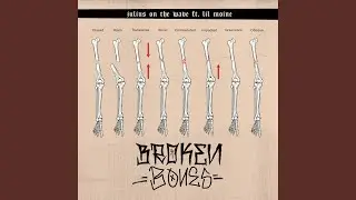 BROKEN BONES