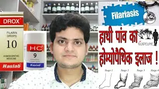 Filariasis ! Homeopathic medicine for Filariasis And elephantiasis ? हाथी पांव का होम्योपैथिक इलाज !