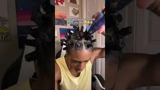 Scalp Burning! #afro #curls #curlyhair #hair #naturalhair #hairstyle #blackhair #curly