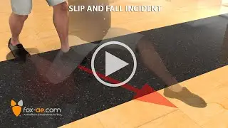 Knee Injury Caused By A Slip On A Wet Surface