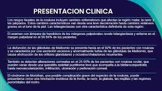 Ros&aacute;cea Ocular