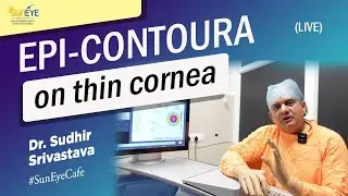 Epi contoura laser surgery in thin cornea patient I epi contoura live #epicontoura #suneyecafe