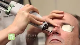 Vbeam&trade; Treatment (pulsed-dye laser that precisely targets visible red vessels on the face) TPD
