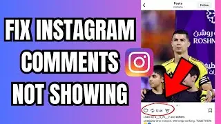 How to fix Instagram Comments Not Showing 2026