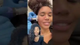 All about Skinpen microneedling