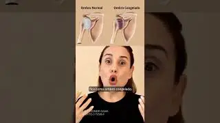 Ombro congelado ou Capsulite Adesiva - Voc&ecirc; sabe o que &eacute;?