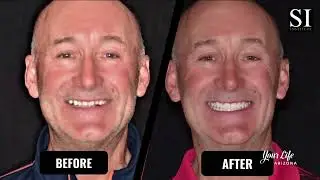 Transforming Smiles Through Expert Dental Implant Education