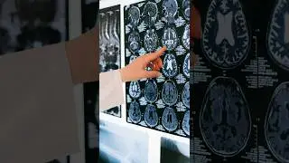 Shocking brain fact 😯|| #facts #shorts