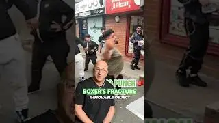 Not A Female Problem 👊🏼 Boxer&rsquo;s Fracture Treatment #shorts
