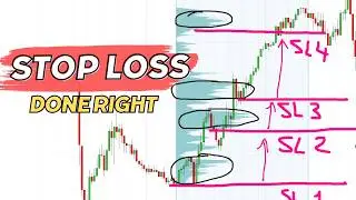 Trailing Stop Loss Done Right: Tips for Safer & Smarter Trading