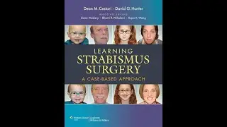 V pattern exotropia with Dr Israa (Lecture 10 )
