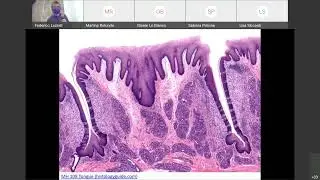 07b Istologia: Epiteli sensoriali. Bottoncini gustativi. Canale B