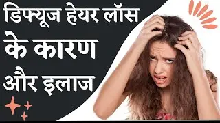 डिफ्यूज हेयर लॉस के कारण और इलाज | Diffuse Hair Loss | Hair Loss Treatment | VHCA Hair Clinic |