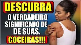 &ldquo;Coceira no Corpo: Descubra o Significado Espiritual da Coceira no Pesco&ccedil;o, Costas e Barriga&rdquo;