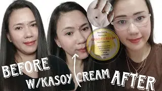 Kasoy Cream Review Effective nga ba?💯yes |Jhees Official ♡