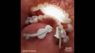 Escapism - RAYE (Clean)