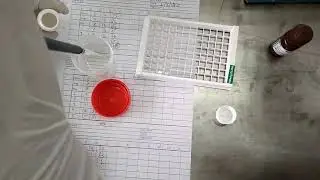 HBsAg ELISA  test procedure
