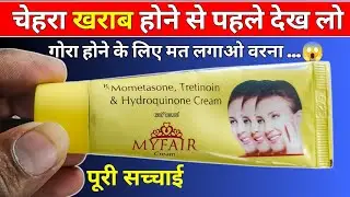Will My Fair Cream make you fair or not? My Fair Cream Review | Gora Hone Wala Cream