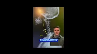 Alignment Matters! | Tylor the Chiropractor | Columbus OH