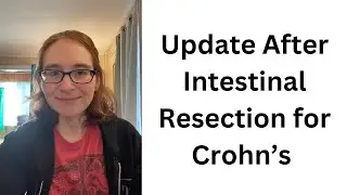 Update After Intestinal Resection for Crohn's
