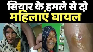 TIKAMGADH : सियार के हमले से दो महिलाएं घायल