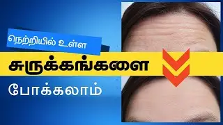 Forehead Wrinkles Removal Home Remedy in Tamil