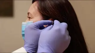 Acupuncture and Breast Cancer Treatment