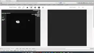 dicom-viewer-5