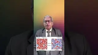 Top #homeopathy medicine for LEUKEMIA -- Dr P S Tiwari