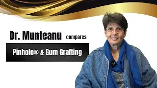Dr. Munteanu Compares Pinhole&reg; & Gum Grafting #pinholesurgicaltechnique #gumgraft #gumrejuvenation