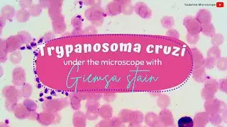 Trypanosoma cruzi under the microscope with Giemsa stain