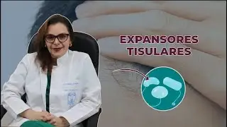 EXPANSORES TISULARES -  DRA. CLAUDIA NIETO