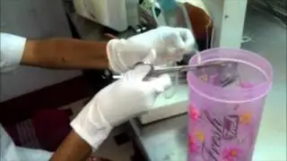 Saline wash procedure for removal of white blood cells at blood bank part -2