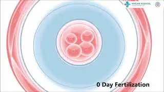 Making families and happiness Neelam Hospital IVF-ICSI Center Explaning IVF in Simple illustration.